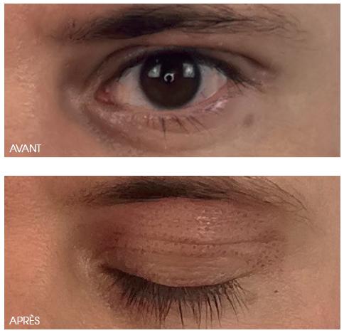 Dermatologie esthétique à Grenoble